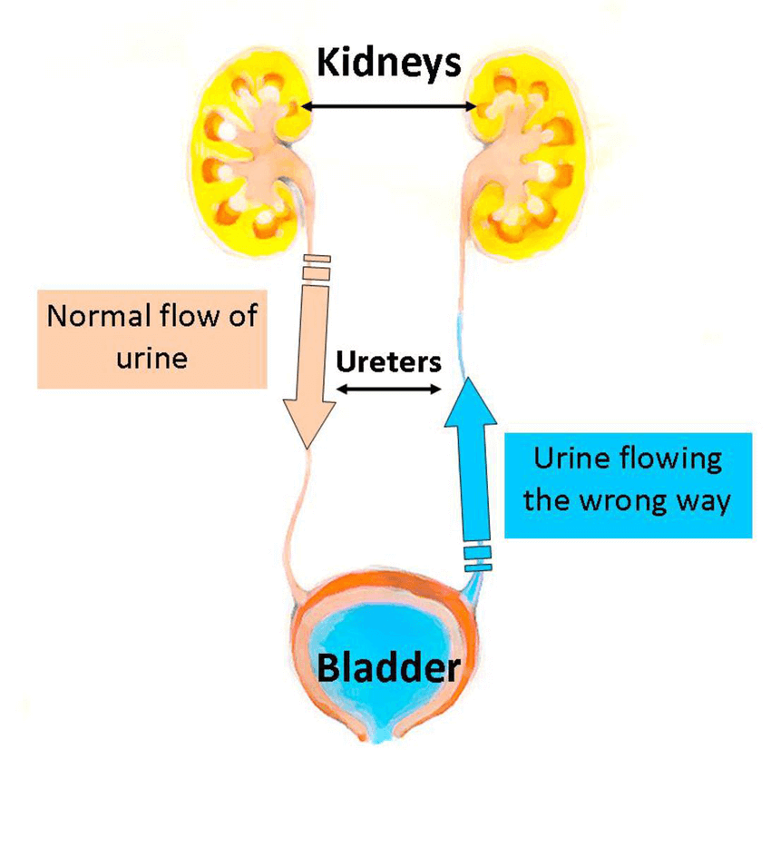 Normal Urine Flow