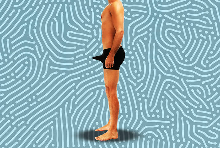 Illustration explaining priapism diagnosis and emergency treatment