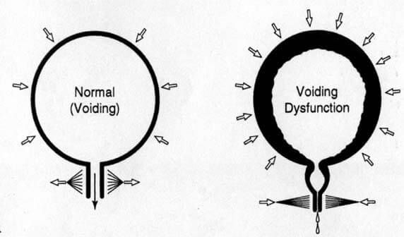 What is Urotherapy?