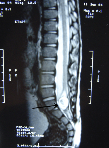 Investigations for Diagnosis